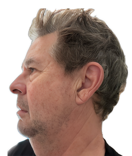 The head of Dr. David C. Ring in left profile without glasses is used for visual identification.